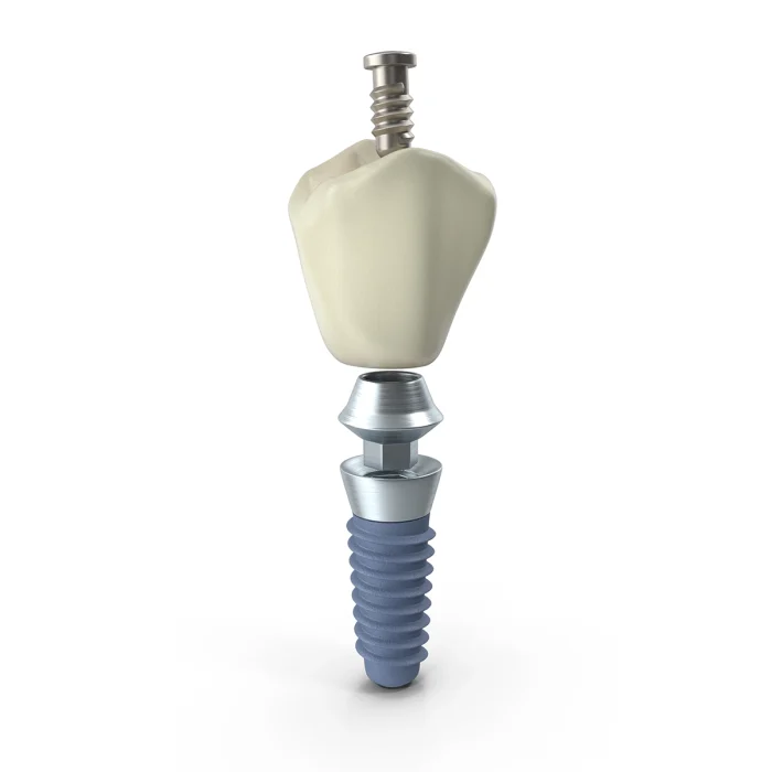 denttrend-prefabs